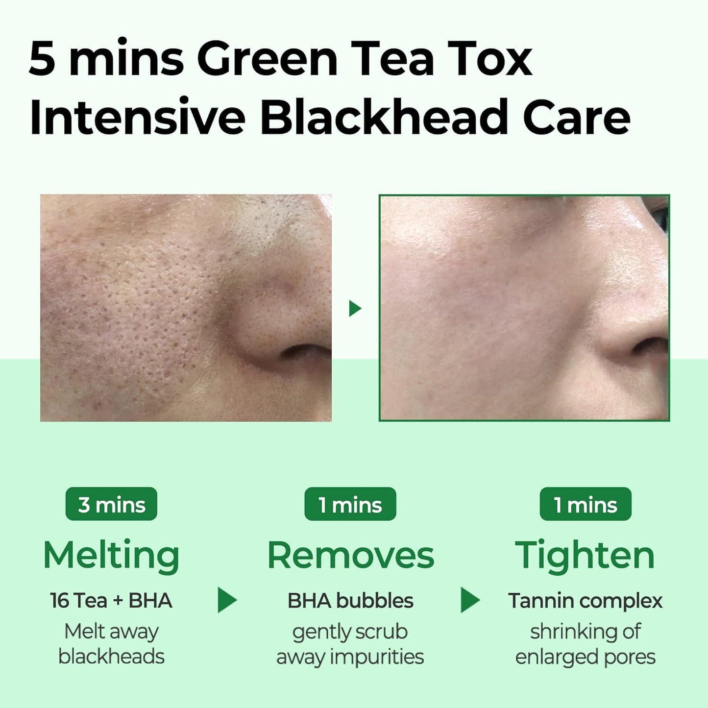 BYE BYE BLACKHEAD 30 DAYS MIRACLE GREEN TEA TOX BUBBLE CLEANSER 120g - PIBU Skincare