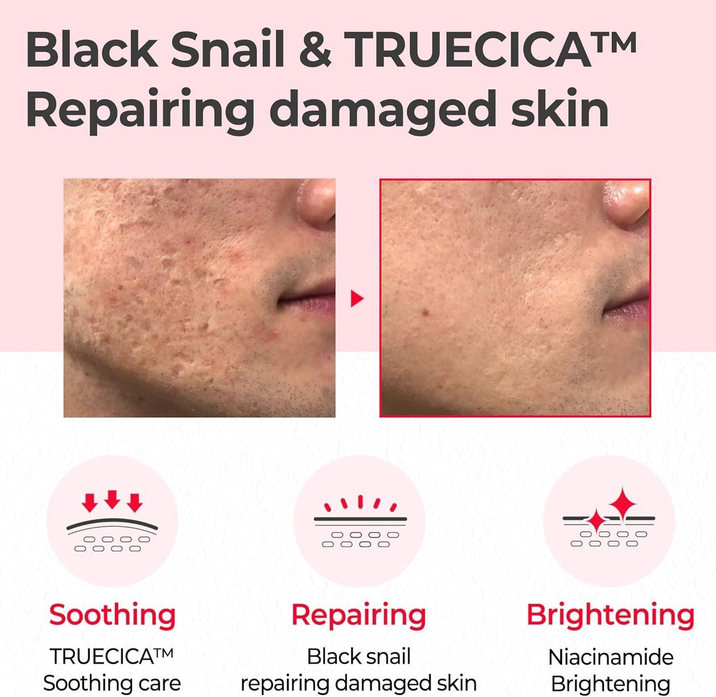 SNAIL TRUECICA MIRACLE REPAIR TONER 150ml - PIBU Skincare