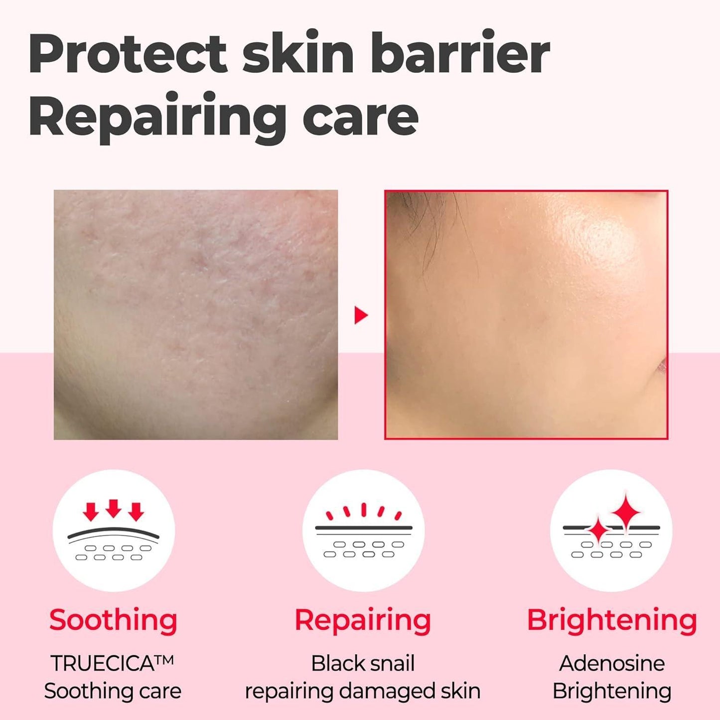 SNAIL TRUECICA MIRACLE REPAIR SERUM 50ml - PIBU Skincare