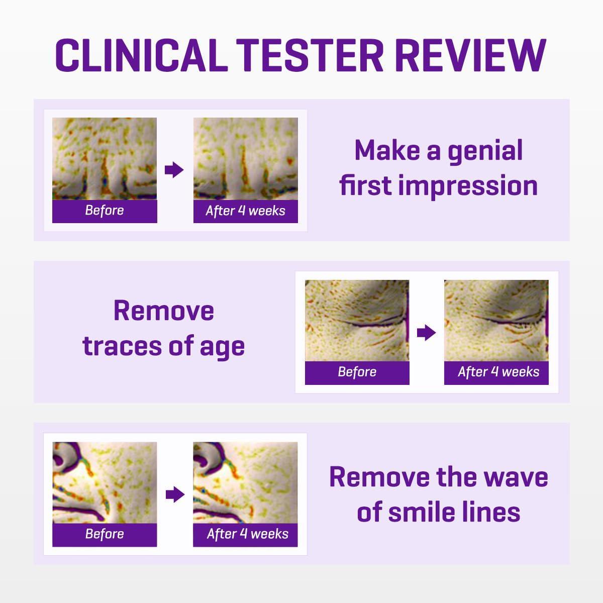 Retinol Intense Advanced Triple Action Eye Cream 30ml - PIBU Skincare