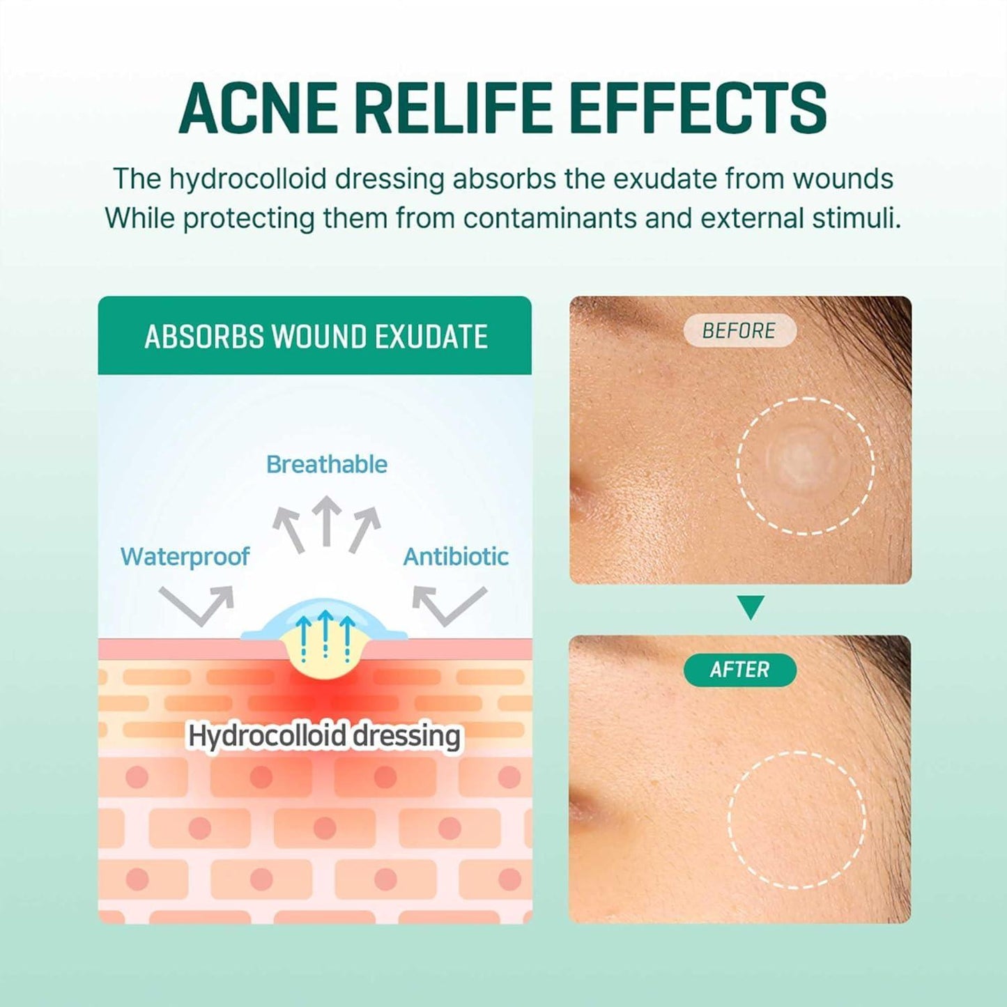 Clear spot patch - PIBU Skincare
