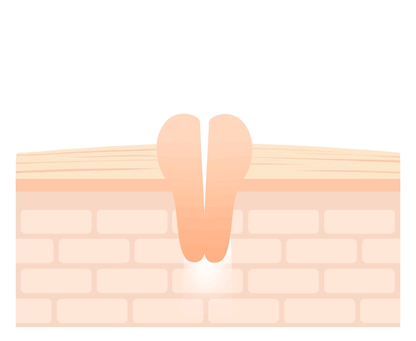 Crossbarrier Mask 30 sheets