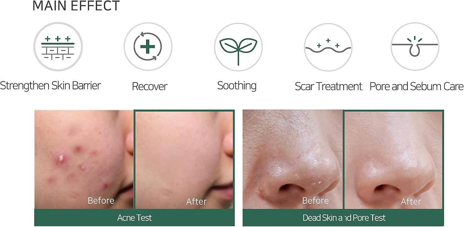AHA-BHA-PHA 30DAYS MIRACLE CREAM 60g - PIBU Skincare