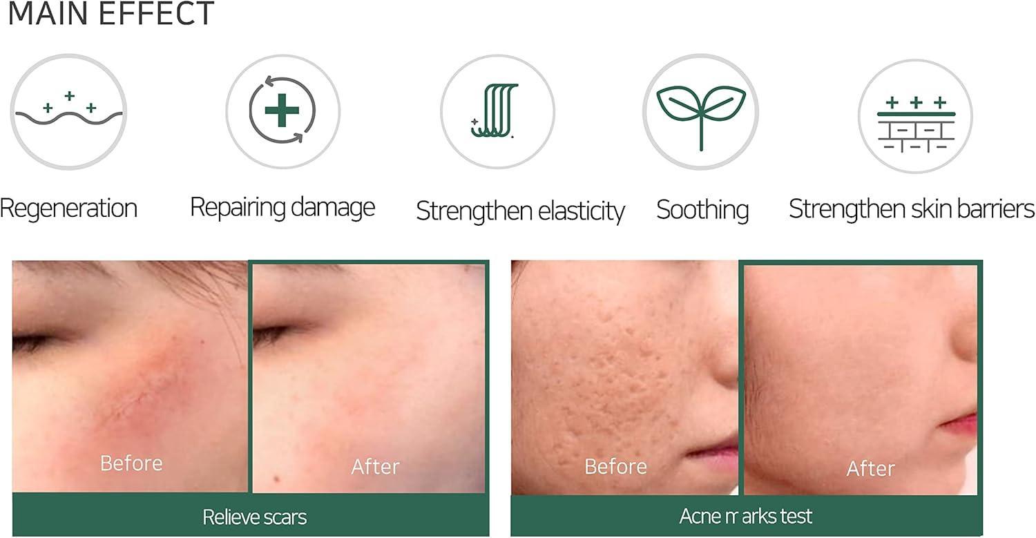 AHA-BHA-PHA 30DAYS MIRACLE CREAM 60g - PIBU Skincare