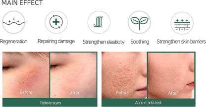 AHA-BHA-PHA 30DAYS MIRACLE CREAM 60g - PIBU Skincare